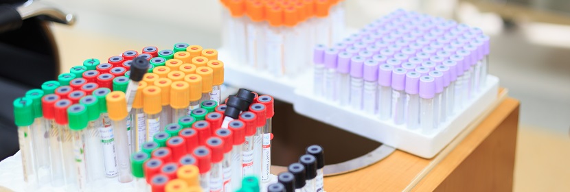 環氧脂肪酸甲酯檢測